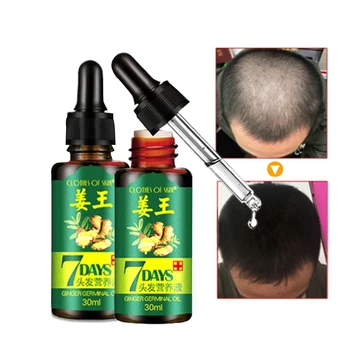 Ginger Hair Treatment Essence Hair Mask Oil For Fast Growth Dry And Damaged Hairs Nutrition Care Products
Ginger Hair Treatment Essence Hair Mask Oil For Fast Growth Dry And Damaged Hairs Nutrition Care Products