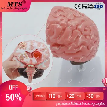 Brain structure anatomy model Brain stroke pathology model Neurology medical teaching aid skull traumatic pistol
Brain structure anatomy model Brain stroke pathology model Neurology medical teaching aid skull traumatic pistol