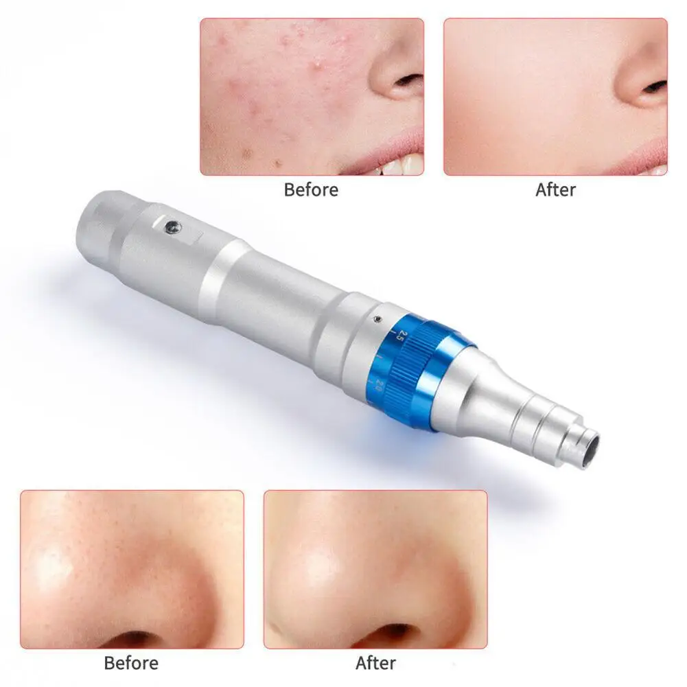 Electric Microneedles MTS Pregnancy Eyelashes Rejuvenation Foundation VC Import Instrument Acne Removal Roller Pen
Electric Microneedles MTS Pregnancy Eyelashes Rejuvenation Foundation VC Import Instrument Acne Removal Roller Pen