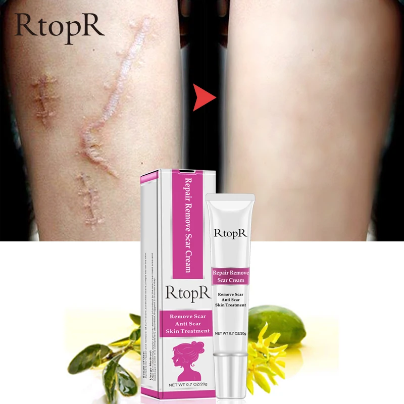 RtopR Hotest Body Scar Stretch Marks Remover Cream Skin Repair Face Creams Acne Spots Acne Treatment Blackhead Whitening Cream
RtopR Hotest Body Scar Stretch Marks Remover Cream Skin Repair Face Creams Acne Spots Acne Treatment Blackhead Whitening Cream