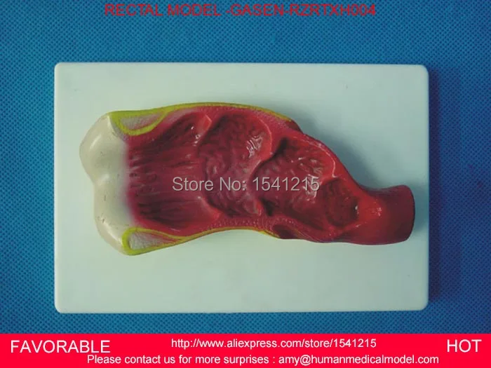 MEDICAL HUMAN OF COLON PATHOLOGICAL ,HUMAN ORGAN , COLORECTAL PATHOLOGICAL MODEL,RECTAL MODEL-GASEN-RZRTXH004
MEDICAL HUMAN OF COLON PATHOLOGICAL ,HUMAN ORGAN , COLORECTAL PATHOLOGICAL MODEL,RECTAL MODEL-GASEN-RZRTXH004
