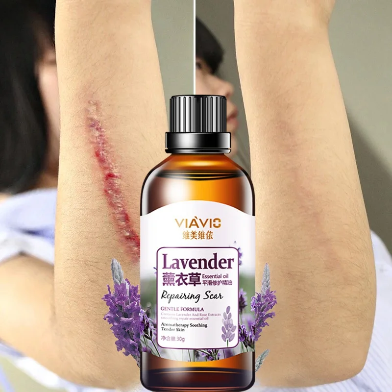 30g Useful Lavender Scar Repair Essential Oil Skin Care Essence Natural Pure Remove Ance Burn Strentch Marks Scar Removal
30g Useful Lavender Scar Repair Essential Oil Skin Care Essence Natural Pure Remove Ance Burn Strentch Marks Scar Removal
