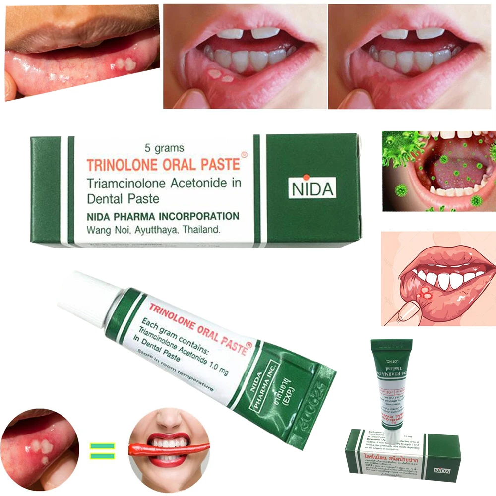Mouth Ulcer Relief Gel Natural Herbal Oral Antibacterial Cream Fast Relief from Severe Pain & Irritation within 2 minutes D227
Mouth Ulcer Relief Gel Natural Herbal Oral Antibacterial Cream Fast Relief from Severe Pain & Irritation within 2 minutes D227