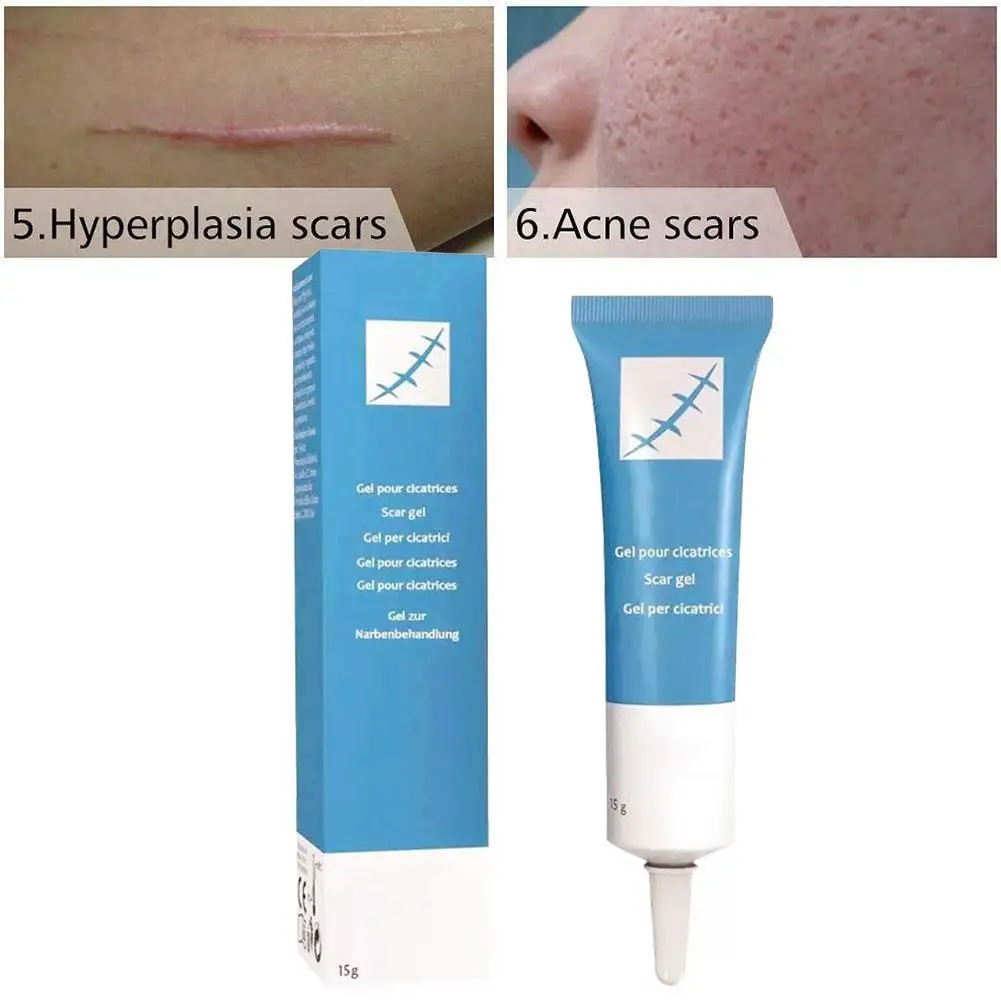 Acne Scar Stretch Marks Removal Cream Skin Repair Face Cream Acne Spots Acne Treatment Scar Remover Cream Skin Care 15g
Acne Scar Stretch Marks Removal Cream Skin Repair Face Cream Acne Spots Acne Treatment Scar Remover Cream Skin Care 15g