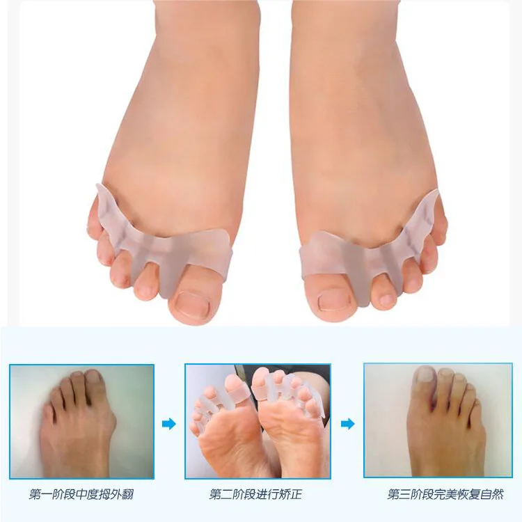 

2Pcs Silicone Thumb Separation Orthosis 4 Holes Foot Care Toe Separator Divider Thumb Bunion Hallux Valgus Correction Protector
