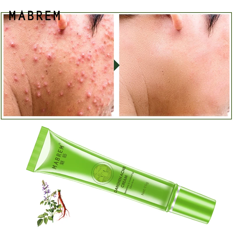 15ML Salvia Acne Treatment Cream Removal Face Blackhead Anti Acne Cream Oil Control Shrink Pores Acne Scar Face Care TSLM2
15ML Salvia Acne Treatment Cream Removal Face Blackhead Anti Acne Cream Oil Control Shrink Pores Acne Scar Face Care TSLM2