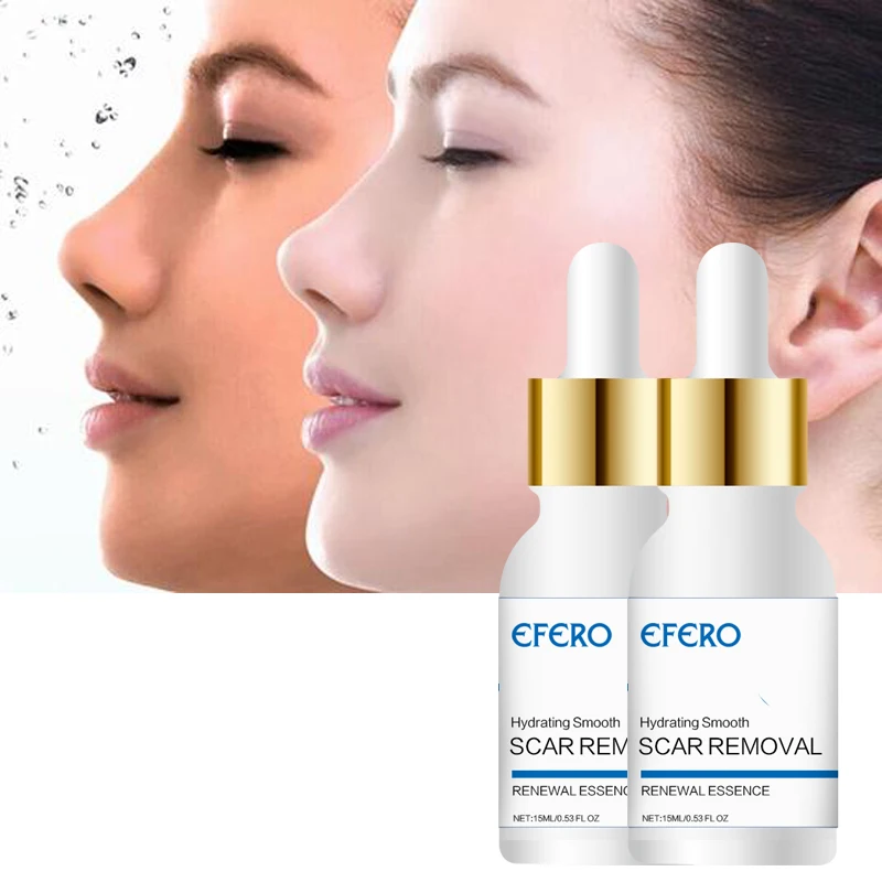 EFERO Acne Removal Face Cream Acne Treatment Essence Spot Repair Serum for Face Care Whitening Cream Remove Pimples Acne
EFERO Acne Removal Face Cream Acne Treatment Essence Spot Repair Serum for Face Care Whitening Cream Remove Pimples Acne