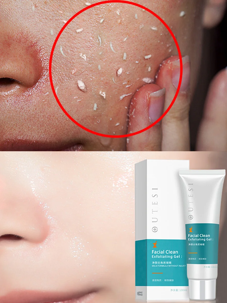 100g Deep Cleansing Aqua Peeling Gel Moisturizes Face Exfoliating Cream Soft Organic Facial Peeling Cream Facial Scrub Cleaner
100g Deep Cleansing Aqua Peeling Gel Moisturizes Face Exfoliating Cream Soft Organic Facial Peeling Cream Facial Scrub Cleaner