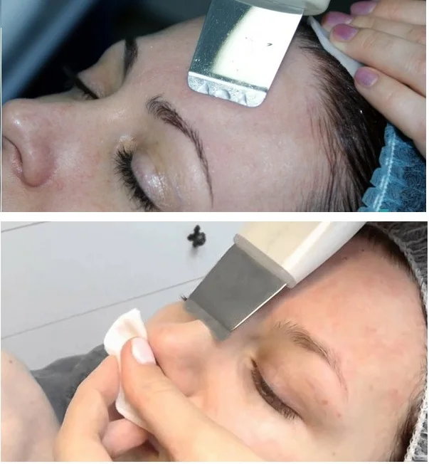 Ultrasonic facial machine jellen