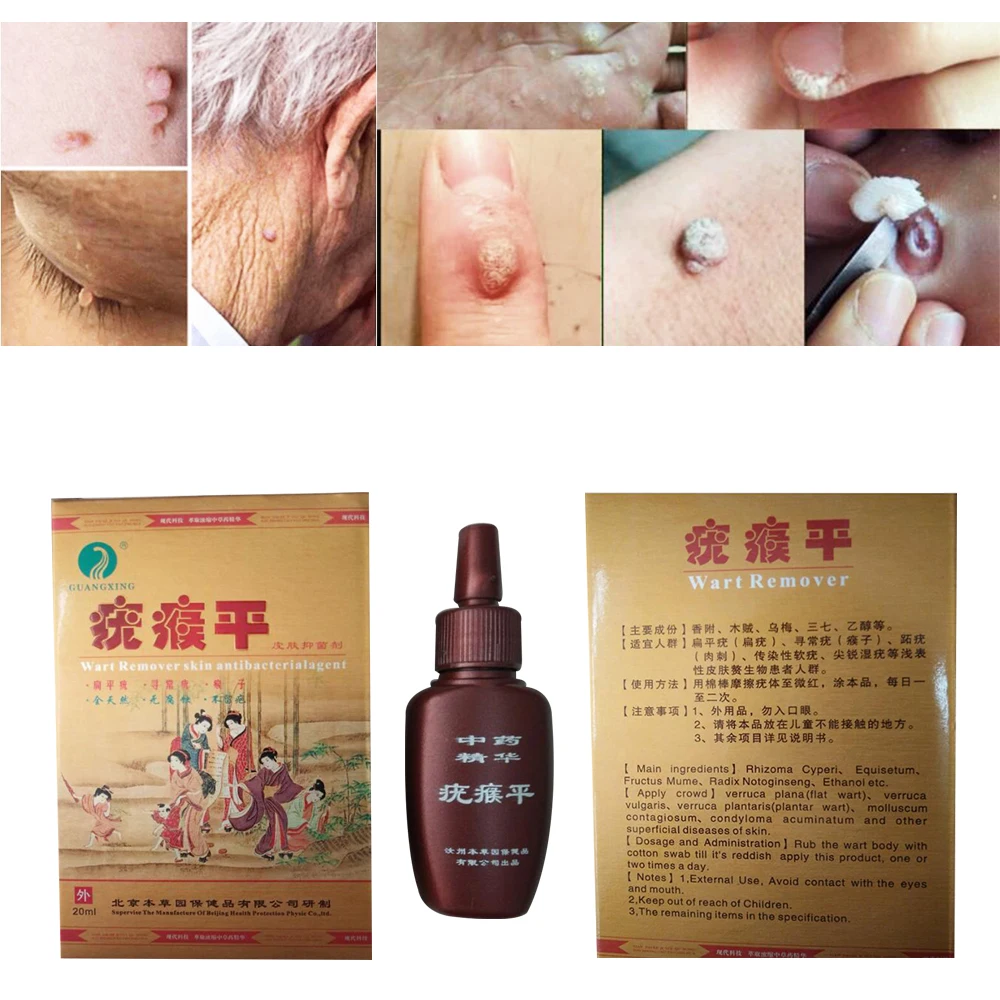 Skin Tag Remover 12 hours Tu kill Medical Tu kill Remover Skin Tag Mole & Genital Wart Remover Dropshipping D229
Skin Tag Remover 12 hours Tu kill Medical Tu kill Remover Skin Tag Mole & Genital Wart Remover Dropshipping D229