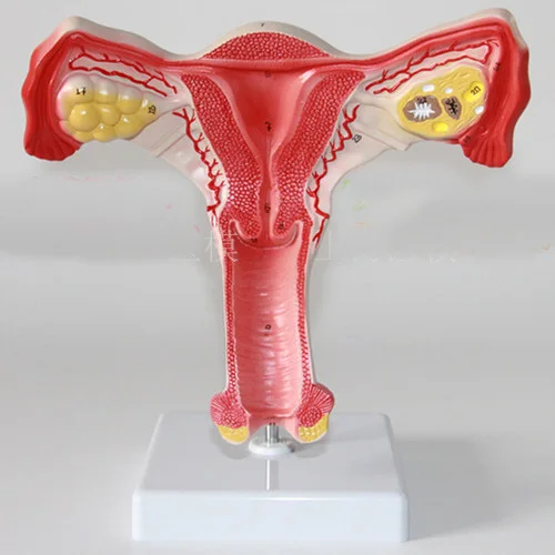 

Ovarian Uterine anatomical model of Obstetrics and Gynecology
