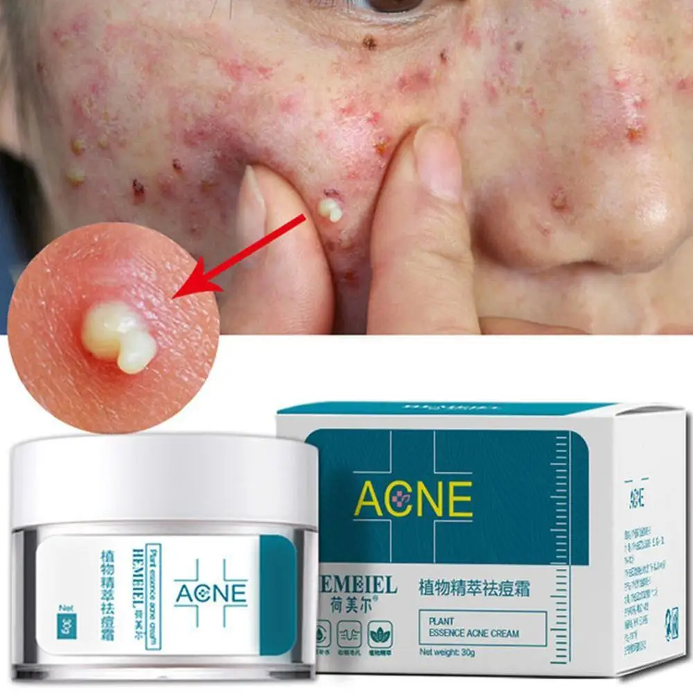 HEMEIEL Acne Treatment Face Cream Anti Acne Scar Removal Pimple Blackhead Moisturizing Whiten Oil-control Shrink Pores Skin Care
HEMEIEL Acne Treatment Face Cream Anti Acne Scar Removal Pimple Blackhead Moisturizing Whiten Oil-control Shrink Pores Skin Care