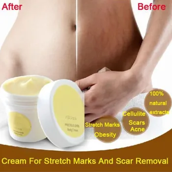 Safety Pregnancy Repairing Cream Stretch Marks Scar Obesity Maternity Skin Body Removal Repair Cream 50g Essence Cream
Safety Pregnancy Repairing Cream Stretch Marks Scar Obesity Maternity Skin Body Removal Repair Cream 50g Essence Cream