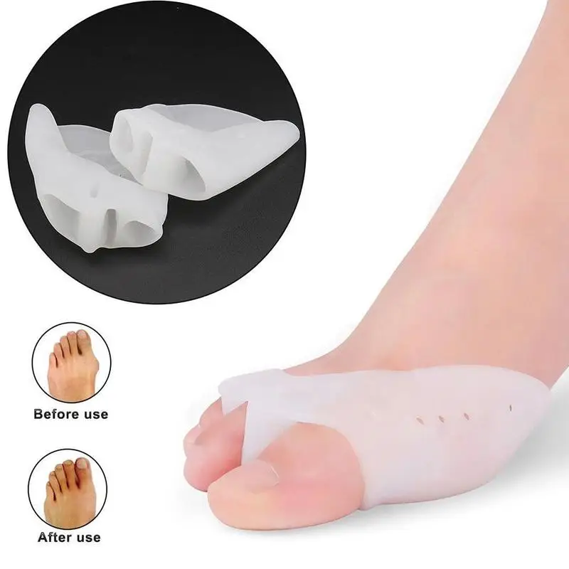 1 Pairs Hallux Valgus Braces Toes Correction Broadhurst Pad Sub-toe Toe Separator Remedical Daily Foot Care Tool
1 Pairs Hallux Valgus Braces Toes Correction Broadhurst Pad Sub-toe Toe Separator Remedical Daily Foot Care Tool
