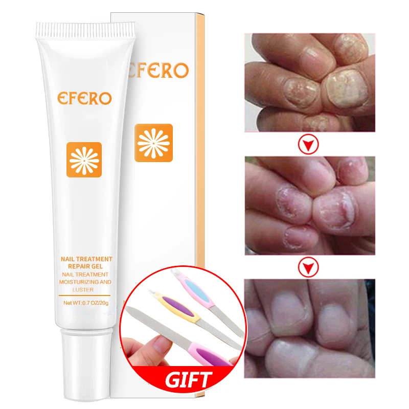 efero Nail Repair Essence Serum Nail Treatment Repair Fungus Nail Toe Nourish Serum Remove Onychomycosis Nail Care Gel Essence
efero Nail Repair Essence Serum Nail Treatment Repair Fungus Nail Toe Nourish Serum Remove Onychomycosis Nail Care Gel Essence