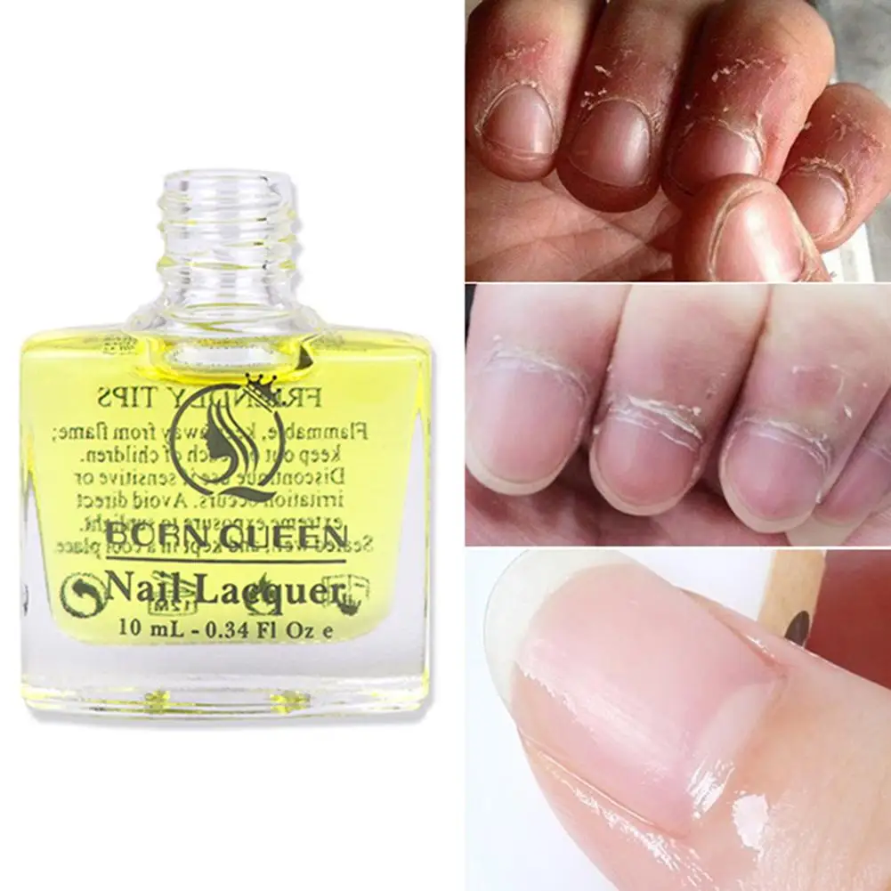 Hand Care Nourishment Oil Nail Brightening Bottom Softening Nutritious Lacquer fashion
Hand Care Nourishment Oil Nail Brightening Bottom Softening Nutritious Lacquer fashion