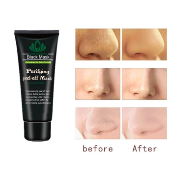 Pure Bamboo charcoal Mask Powder Algae Mask Acne Spots Remove Hyrdating Whitening&Moisturizing Facial Mask Face Mask
Pure Bamboo charcoal Mask Powder Algae Mask Acne Spots Remove Hyrdating Whitening&Moisturizing Facial Mask Face Mask