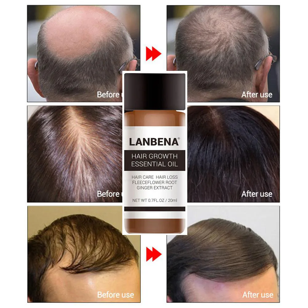 Natural Plant Extract Hair Growth Essence Oil Hairs Regeneration Repair Chinese Herbal Medicine Serum Conditioner
Natural Plant Extract Hair Growth Essence Oil Hairs Regeneration Repair Chinese Herbal Medicine Serum Conditioner