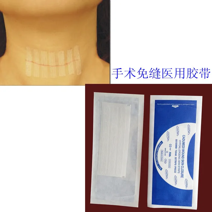 5pcs Expired 12*100mm 3strips health tape breathable tape disembowelment scar repair cerecloths producing
5pcs Expired 12*100mm 3strips health tape breathable tape disembowelment scar repair cerecloths producing