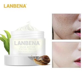 Snail Deep Repair Whitening Facial Cream Day Cream Anti Wrinkle Aging Acne Scars Treatment Moisturizing Skin Care Delicate Face
Snail Deep Repair Whitening Facial Cream Day Cream Anti Wrinkle Aging Acne Scars Treatment Moisturizing Skin Care Delicate Face