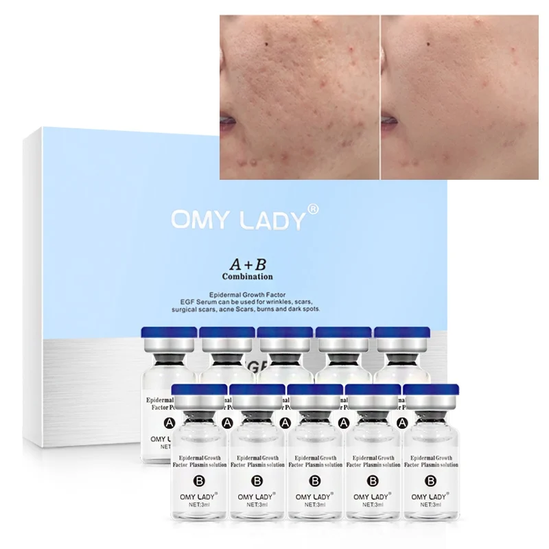 Natural Skin Rejuvenation Serum Acne Treatment Repair Face Skin Care Serum Lightening Pigment Brighten Face Cream
Natural Skin Rejuvenation Serum Acne Treatment Repair Face Skin Care Serum Lightening Pigment Brighten Face Cream