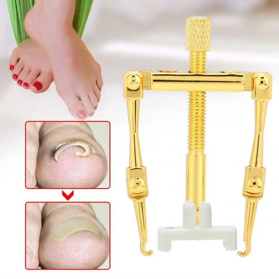 Professional Ingrown Toenail Fixer Adjustable Toe Nail Paronychia Corrector Pedicure Tool Foot Care
Professional Ingrown Toenail Fixer Adjustable Toe Nail Paronychia Corrector Pedicure Tool Foot Care