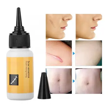LIDORIA 20ML Essence Scar Stretch Marks Removal Skin Repair Cream Spot Removing Treatment Scar Removal Cream
LIDORIA 20ML Essence Scar Stretch Marks Removal Skin Repair Cream Spot Removing Treatment Scar Removal Cream
