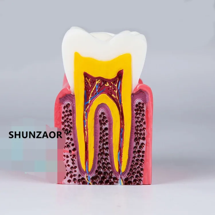 S6X Zoom Caries Tooth Model Dentist Patient Communication Anatomy Monomer Model Teaching Aids Equipment
S6X Zoom Caries Tooth Model Dentist Patient Communication Anatomy Monomer Model Teaching Aids Equipment