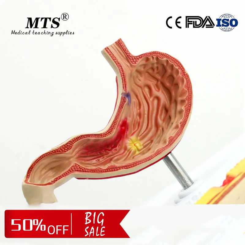 Medical teaching human Digestive System Model Gastric Ulcer Model stomach Perforation Gastric Anatomical Pathology Model
Medical teaching human Digestive System Model Gastric Ulcer Model stomach Perforation Gastric Anatomical Pathology Model