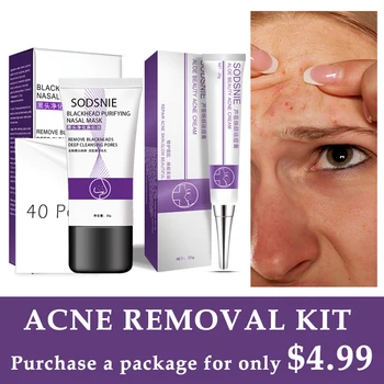 Blackhead Remover Nose Mask+Aloe Beauty Acne cream kit Skin Care Acne Treatment Pimple Cream Anti Acne Scar Facial Care Tools
Blackhead Remover Nose Mask+Aloe Beauty Acne cream kit Skin Care Acne Treatment Pimple Cream Anti Acne Scar Facial Care Tools