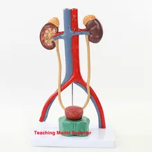 Model-Kidney-Model Urinary-System Arteriovenous-Model Renal Medical-Teaching Human-Anatomy