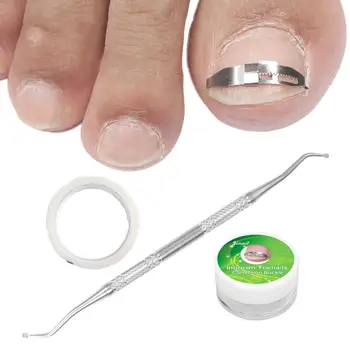 Stainless Steel Toe Nail Correction Tool Pedicure Nail Care Hook Toe Nail Straightening Clip Armor Corrector Patch Tool Set
Stainless Steel Toe Nail Correction Tool Pedicure Nail Care Hook Toe Nail Straightening Clip Armor Corrector Patch Tool Set