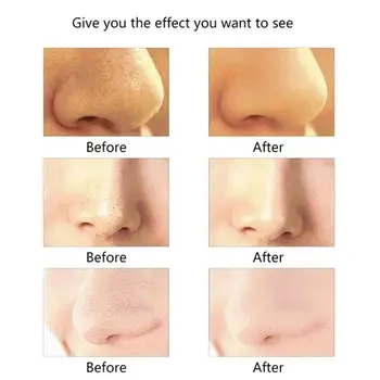 Electric Blackhead Artifact Remover Pore Machine Acne Face Wash Clean Tool Instrument Care Cleansing Skin Instrument P9O7
Electric Blackhead Artifact Remover Pore Machine Acne Face Wash Clean Tool Instrument Care Cleansing Skin Instrument P9O7