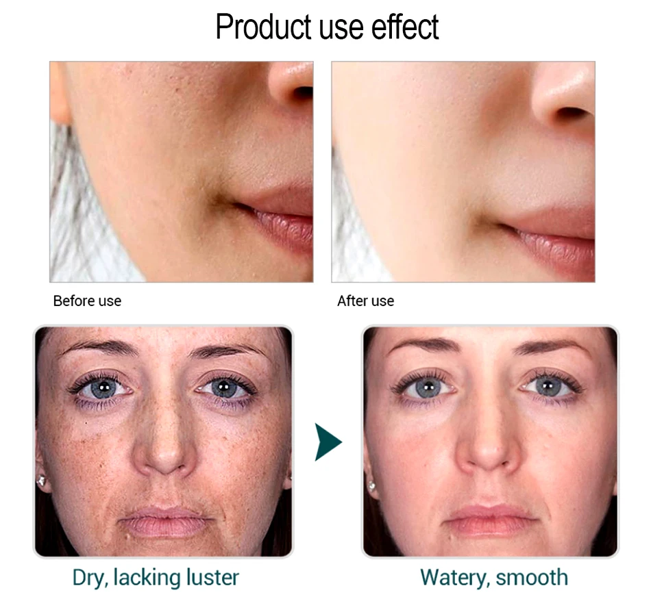 OMY LADY Hyaluronic Acid Moisturizing Face Cream Anti-Wrinkle Anti-Aging Whitening Lifting Firm Brighten Day Cream Skin Care OMY LADY Hyaluronic Acid Moisturizing Face Cream Anti-Wrinkle Anti-Aging Whitening Lifting Firm Brighten Day Cream Skin Care