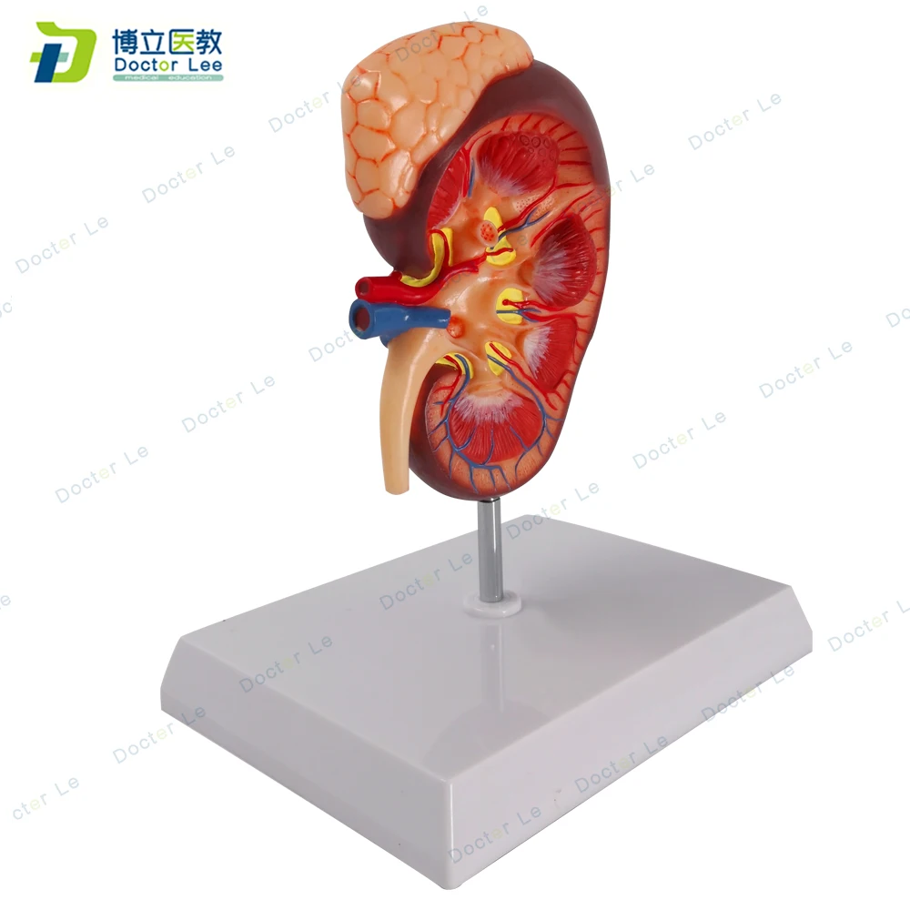 Medical Teaching of Urinary System and Renal Structure for 2 times Enlarged Kidney Anatomy Model in Human Urology Department
Medical Teaching of Urinary System and Renal Structure for 2 times Enlarged Kidney Anatomy Model in Human Urology Department