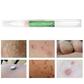 Body Warts Treatment Cream Skin Tag Remover Wart Corn Cream Light Net Flat 3ml Care Foot Patch Foot Remover Wart Corns B6O7 
Body Warts Treatment Cream Skin Tag Remover Wart Corn Cream Light Net Flat 3ml Care Foot Patch Foot Remover Wart Corns B6O7