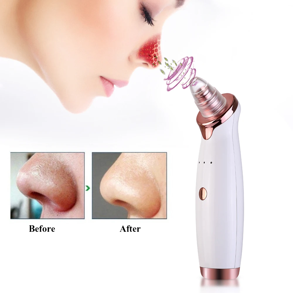 Blackhead Remover Vacuum Portable Facial Pore Cleanser Electric Acne Removal Kit USB Rechargeable Blackhead Suction Tool
Blackhead Remover Vacuum Portable Facial Pore Cleanser Electric Acne Removal Kit USB Rechargeable Blackhead Suction Tool