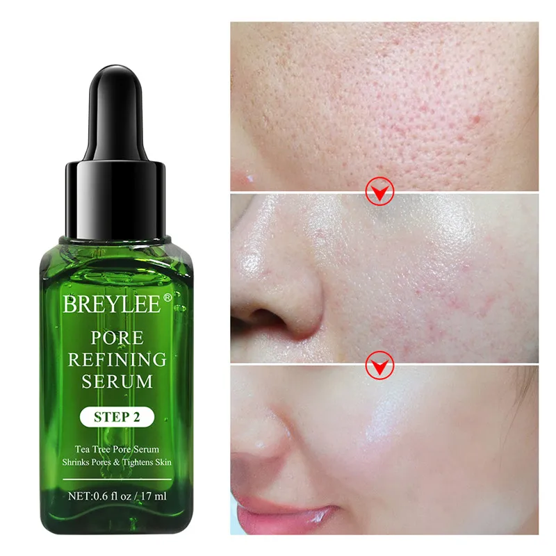 17ml Pore Refining Serum Shrink Pores Tightens Skin Care Essence Whitening Moisturizing Anti-aging Oil Control Facial Essence
17ml Pore Refining Serum Shrink Pores Tightens Skin Care Essence Whitening Moisturizing Anti-aging Oil Control Facial Essence
