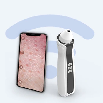 Electric suction Black Head Remove device Vacuum pore Clean skin Rejuvenation Device black dot Visible smart machine whitening
Electric suction Black Head Remove device Vacuum pore Clean skin Rejuvenation Device black dot Visible smart machine whitening
