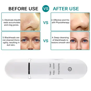 Skin Scrubber Black Head Cleaner Blackhead Removal Equipment White EMS Ultrasound Fast Effective Multifunction Acne Beauty
Skin Scrubber Black Head Cleaner Blackhead Removal Equipment White EMS Ultrasound Fast Effective Multifunction Acne Beauty