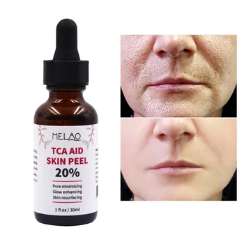 Wholesale 30ml Trichloroaectic Acid 20% Skin Peel Pore Minizing Wrinkles Spots Face Serum
Wholesale 30ml Trichloroaectic Acid 20% Skin Peel Pore Minizing Wrinkles Spots Face Serum