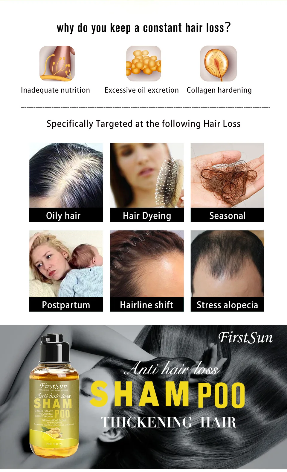 2Pcs 100ML Herbal Ginger Shampoo for Hair Growth Treatment for Hair Loss Thicker Fuller Hair Anti Dandruff Women & Men Hair Care 2Pcs 100ML Herbal Ginger Shampoo for Hair Growth Treatment for Hair Loss Thicker Fuller Hair Anti Dandruff Women & Men Hair Care
