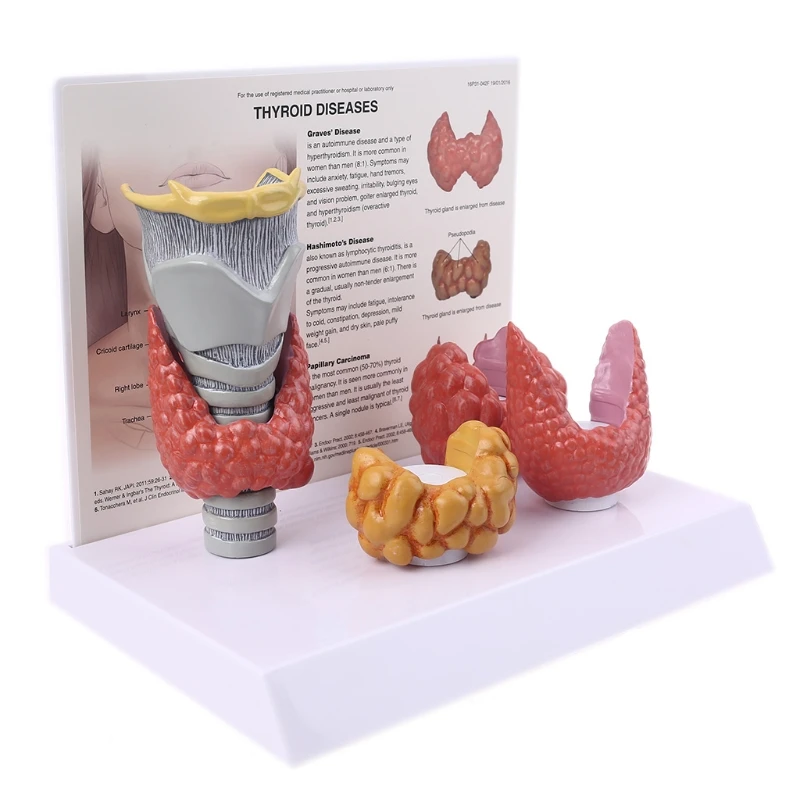 Human Anatomical Thyroid Gland Model Pathology Anatomy Digestive System Display Study Teaching Tool Halloween | Канцтовары для