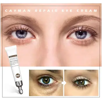 Peptide Collagen Eye Cream Anti-Wrinkle Remover Dark Against 20ml Care Circles Puffiness Eye X5O9
Peptide Collagen Eye Cream Anti-Wrinkle Remover Dark Against 20ml Care Circles Puffiness Eye X5O9