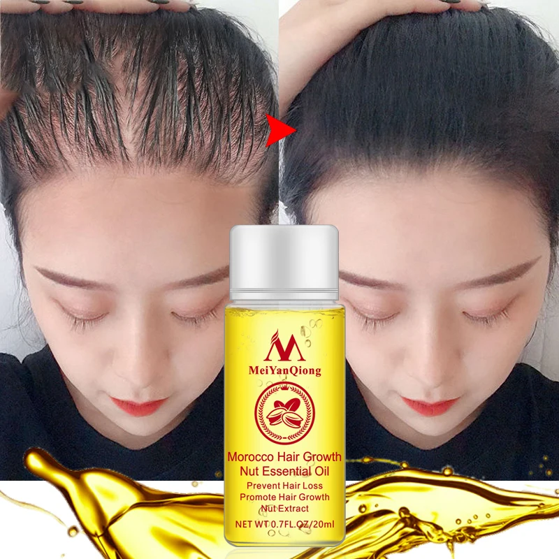 

New Hair Growth Products Ginger Oil Hair Growth Faster Grow Hair Ginger Shampoo Essence Hair Loss Treatment Help Hair Care 20ml