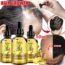 7 day Ginger Hair Growth Nutrient Solution Hair Loss Treatment Hair Protection Essential Oil for Men Women Conditioner hair
7 day Ginger Hair Growth Nutrient Solution Hair Loss Treatment Hair Protection Essential Oil for Men Women Conditioner hair