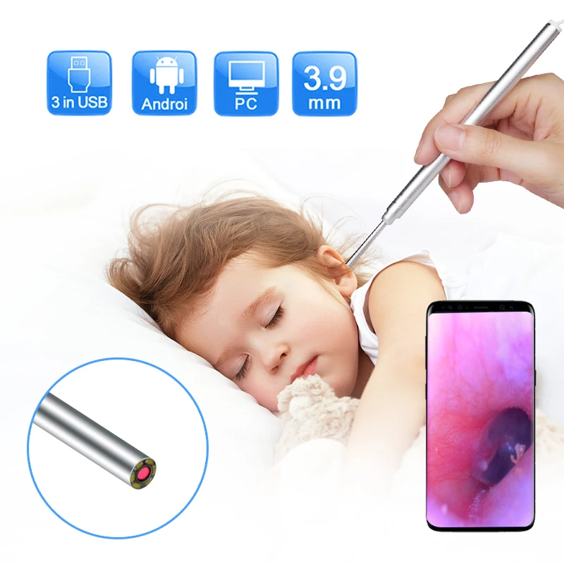 USB Otoscope Ear Cleaner 720P HD Digital Ear Camera 3 in 1 Borescope Inspection Earwax Removal Tool with 6 LED or Android PC
USB Otoscope Ear Cleaner 720P HD Digital Ear Camera 3 in 1 Borescope Inspection Earwax Removal Tool with 6 LED or Android PC
