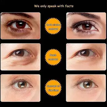 Snake Eye Cream Removal Dark Circle Eyes Bags Cream Cream Eye Moisturizing Granule Anti-Aging Fat Care Anti-Puffi Eye P4J5 
Snake Eye Cream Removal Dark Circle Eyes Bags Cream Cream Eye Moisturizing Granule Anti-Aging Fat Care Anti-Puffi Eye P4J5