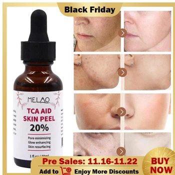 30ml Tca Aid Skin Peel Trichloroaectic Acid 20% Skin Peel Pore Minizing Wrinkles Spots Skin Care Face Serum
30ml Tca Aid Skin Peel Trichloroaectic Acid 20% Skin Peel Pore Minizing Wrinkles Spots Skin Care Face Serum