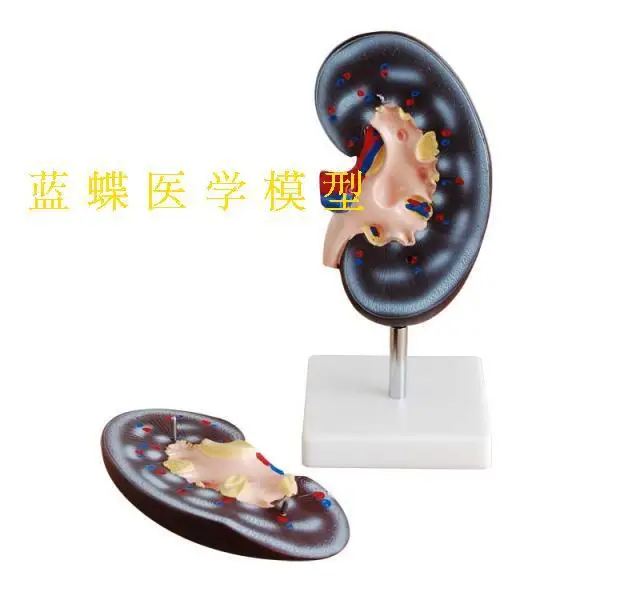 2X Enlarged Renal Anatomy Model The Anatomical Model of Human Kidney Amplification of The Kidney Model Medical Teaching Supplies 
2X Enlarged Renal Anatomy Model The Anatomical Model of Human Kidney Amplification of The Kidney Model Medical Teaching Supplies